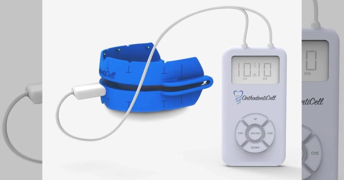 OrthodontiCell Secures Funding for Phase II Teeth Study